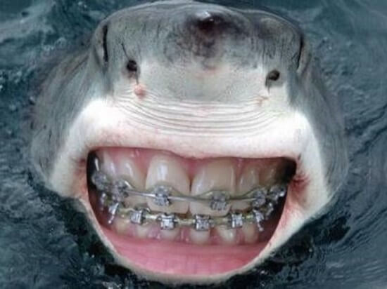 shark-with-human-teeth-6.jpg